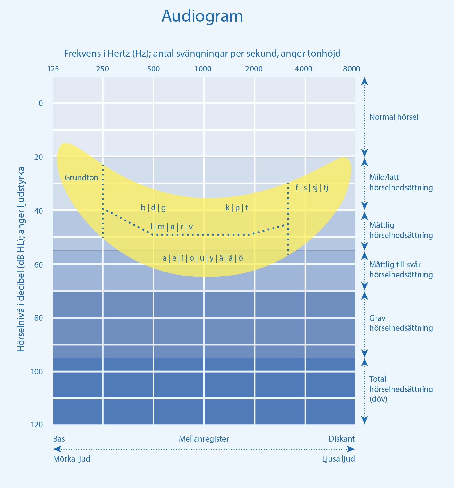 Audiogram med "talbananen"