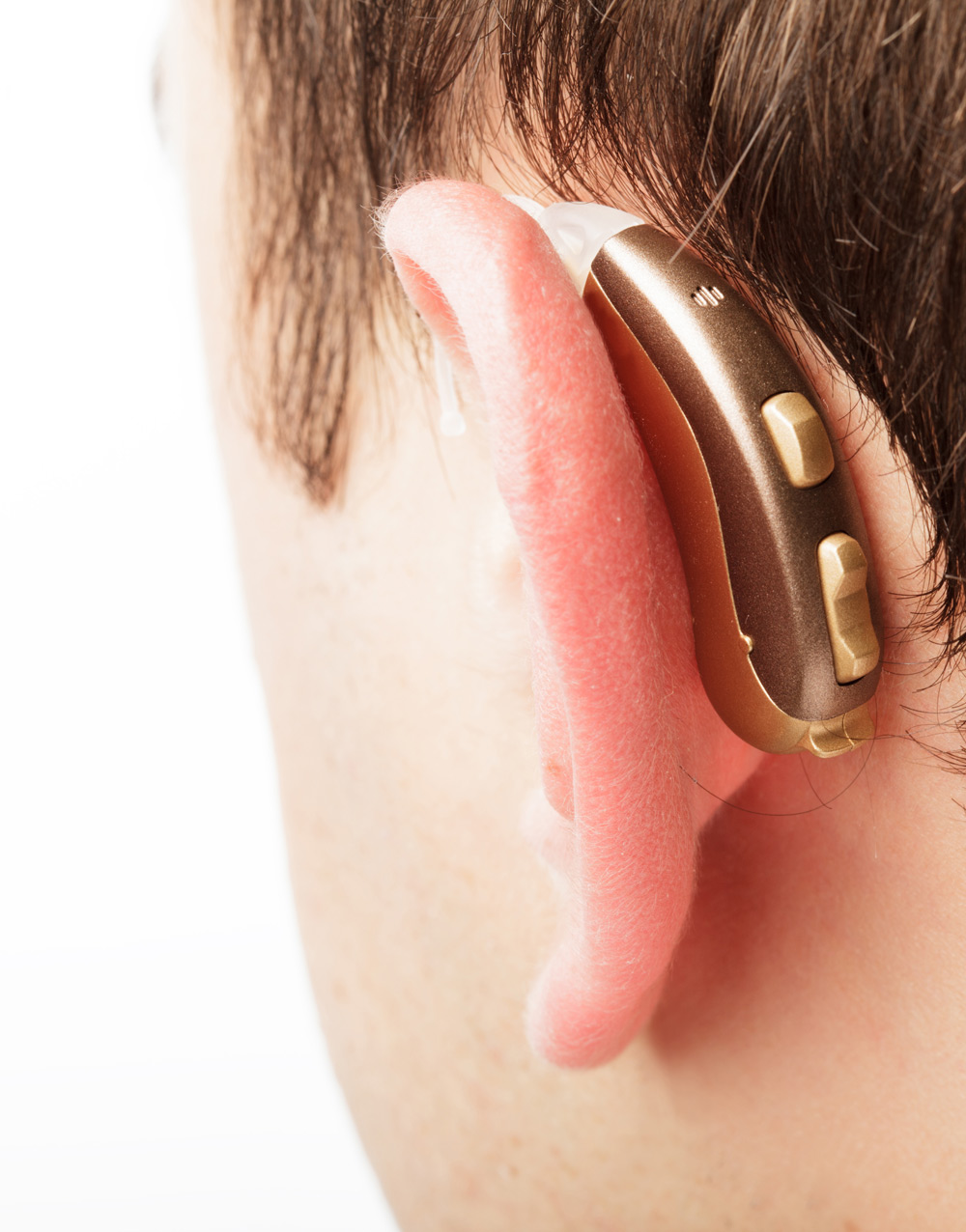 Слуховой Аппарат У 03 Купить